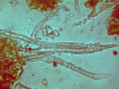 Ilex31.jpg
