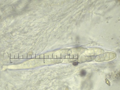 Lophiostoma compressum ascus.jpg