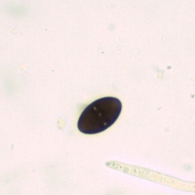Paraxylaria xylostei H2O_1000.jpg