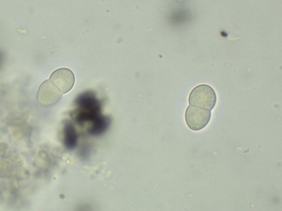 Psiloglonium lineare H2O_1000_5.jpg