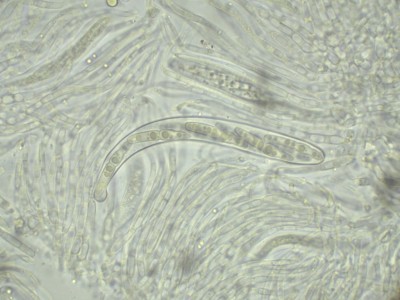 Setoseptoria arundinacea Ascus H2O_1000_16.jpg