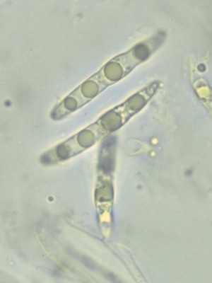 Setoseptoria arundinacea sporen H2O__1000_5.jpg