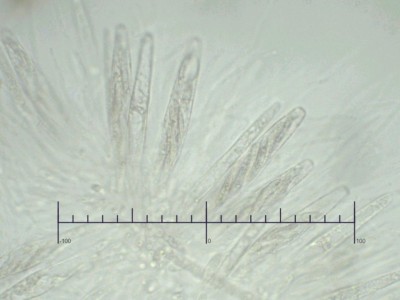 Echinosphaeria strigosa ascus.jpg