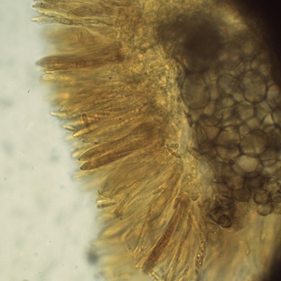 04 Pyrenopeziza pulveracea Lugol_1000.jpg