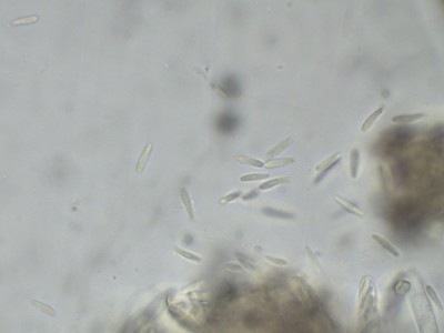 06 Pyrenopeziza pulveracea H2O_1000_9.jpg