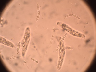 08 Cryptosporella betulae CR_1000.jpg