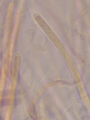 04_Cordyceps militaris CR_1000_6.jpg