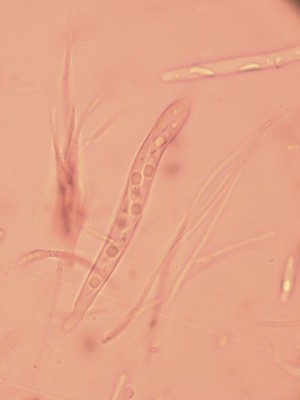 05 Cyathicula coronata CR_1ß00_3.jpg