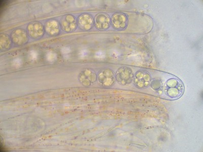 05 Pulvinula convexella H2O_1000.jpg
