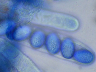 02Scutellinia scutellata CB_1000_4.jpg