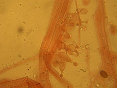 Caulozystiden: ebenfalls lecithiform