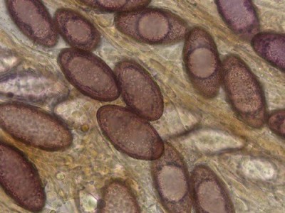 014661_ascobolus_xylophilus_ARGE2026_002.jpg