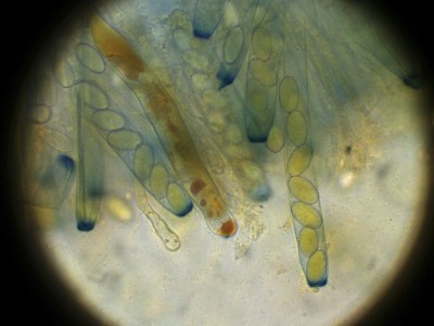 Barals_1000_1.jpg