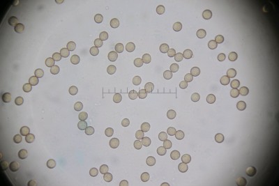 Stemonitis mit Maßstab.jpg