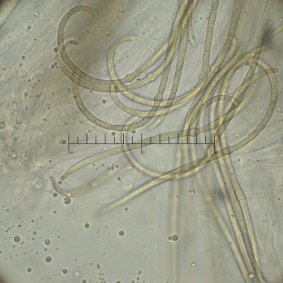 Nodulosphaeria cirsii_asci.jpg