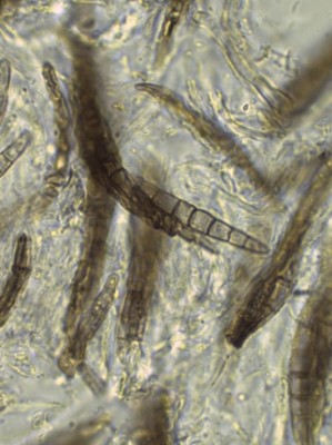 Leptosphaeria acuta_sporen2.jpg