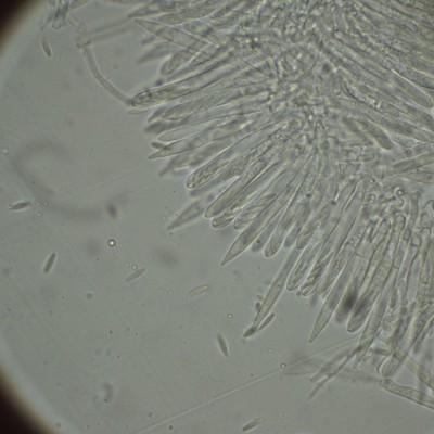 Brunnipila fuscescens Andreas_H2O_1000_11.jpg