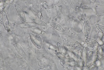 Lepiota oreadiformis aff. mikr (9).JPG