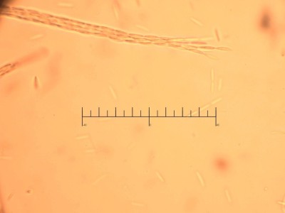 ascus + sporen2.jpg
