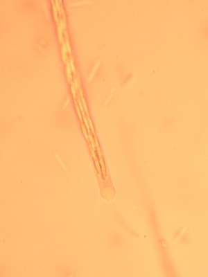 Ascus kongo_1000_1_3.jpg