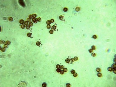 Sporen 4,5 - 5,7