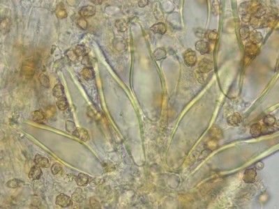 Pleurozystiden