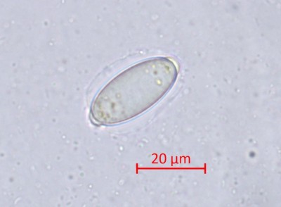 Spore mit Schleimhülle und "Knubbel" an beiden Enden.